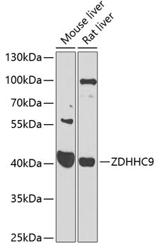 ZDHHC9 Antibody in Western Blot (WB)
