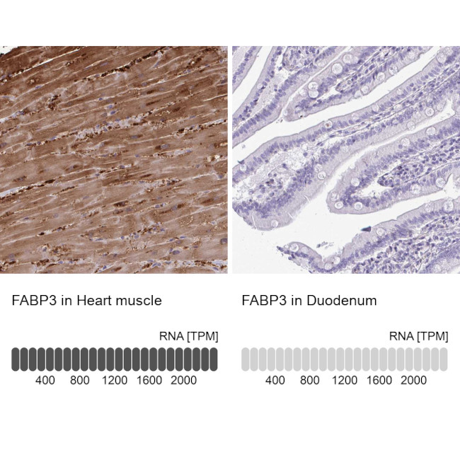 FABP3 Antibody in Immunohistochemistry (IHC)