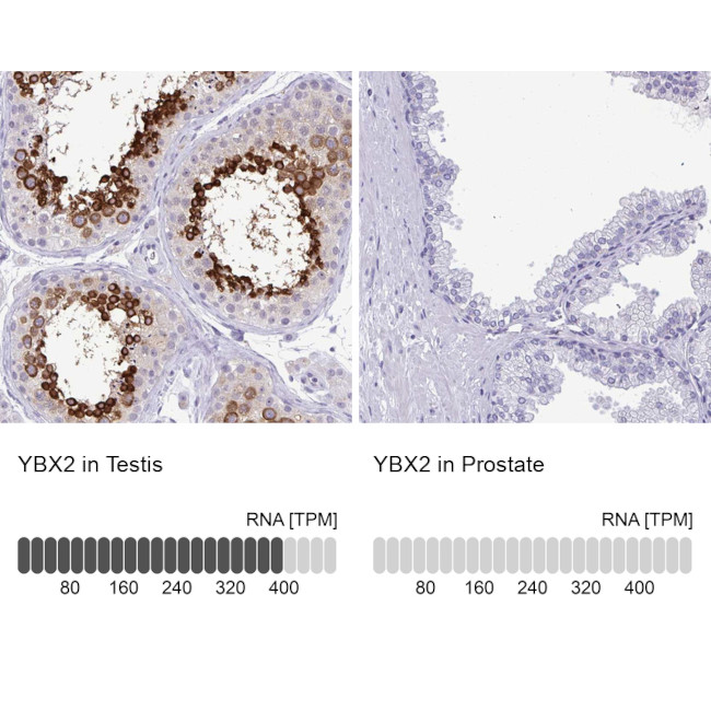 YBX2 Antibody in Immunohistochemistry (IHC)
