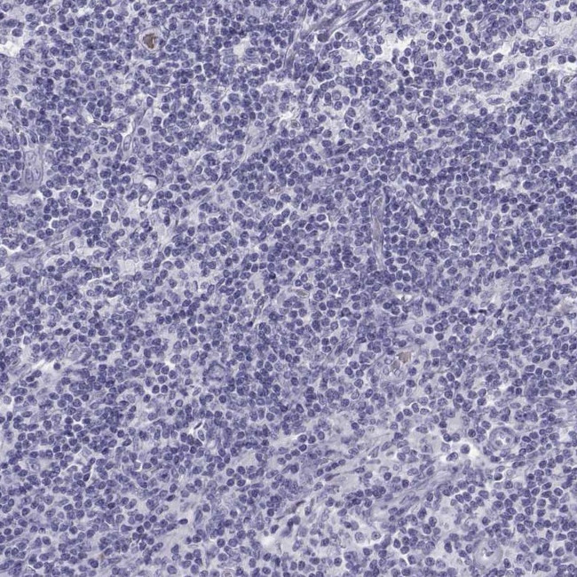 SEMG1 Antibody in Immunohistochemistry (IHC)