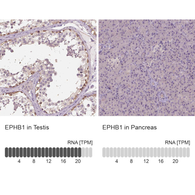 EphB1 Antibody in Immunohistochemistry (IHC)