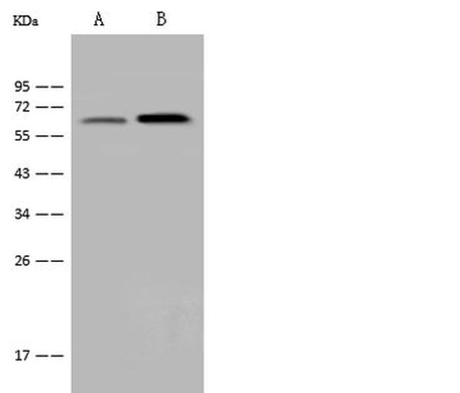B3GNT3 Antibody in Western Blot (WB)