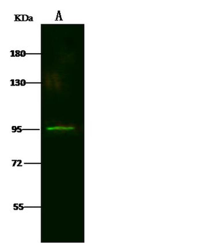 LRRC8B Antibody in Western Blot (WB)