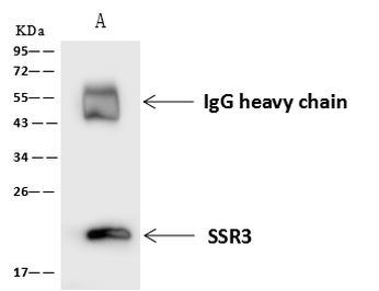 SSR3 Antibody in Immunoprecipitation (IP)