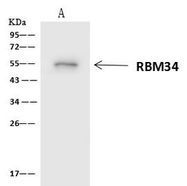 RBM34 Antibody in Immunoprecipitation (IP)