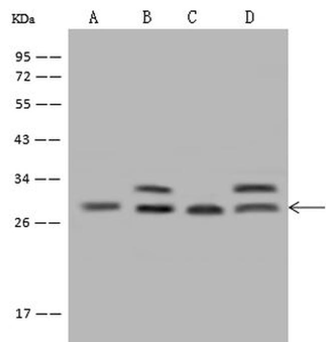 PDCD10 Antibody in Western Blot (WB)