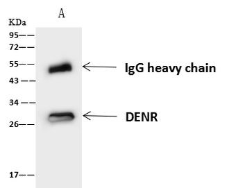 DENR Antibody in Immunoprecipitation (IP)