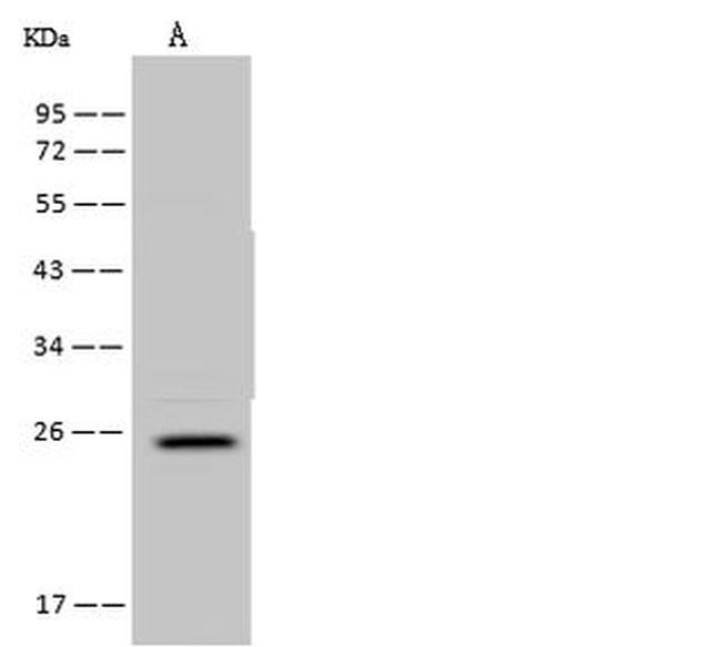 FA156 Antibody in Western Blot (WB)