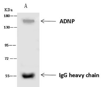ADNP Antibody in Immunoprecipitation (IP)