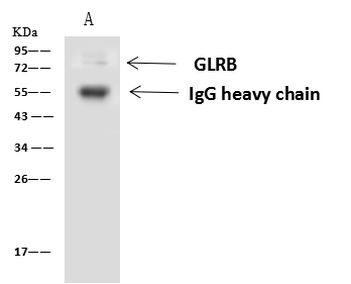 GLRB Antibody in Immunoprecipitation (IP)