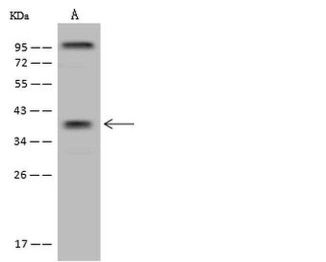 ST6GALNAC5 Antibody in Western Blot (WB)