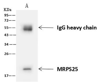 MRPS25 Antibody in Immunoprecipitation (IP)