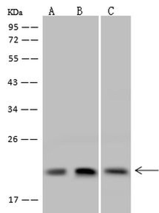 Dynactin 3 Antibody in Western Blot (WB)