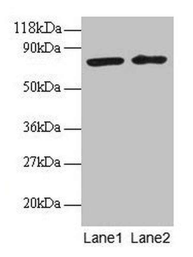 BLOC1S1 Antibody in Western Blot (WB)