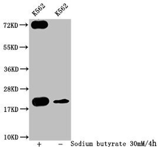 Formyl-Histone H1.2 (Lys109) Antibody in Western Blot (WB)