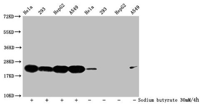 Formyl-Histone H1.2 (Lys96) Antibody in Western Blot (WB)