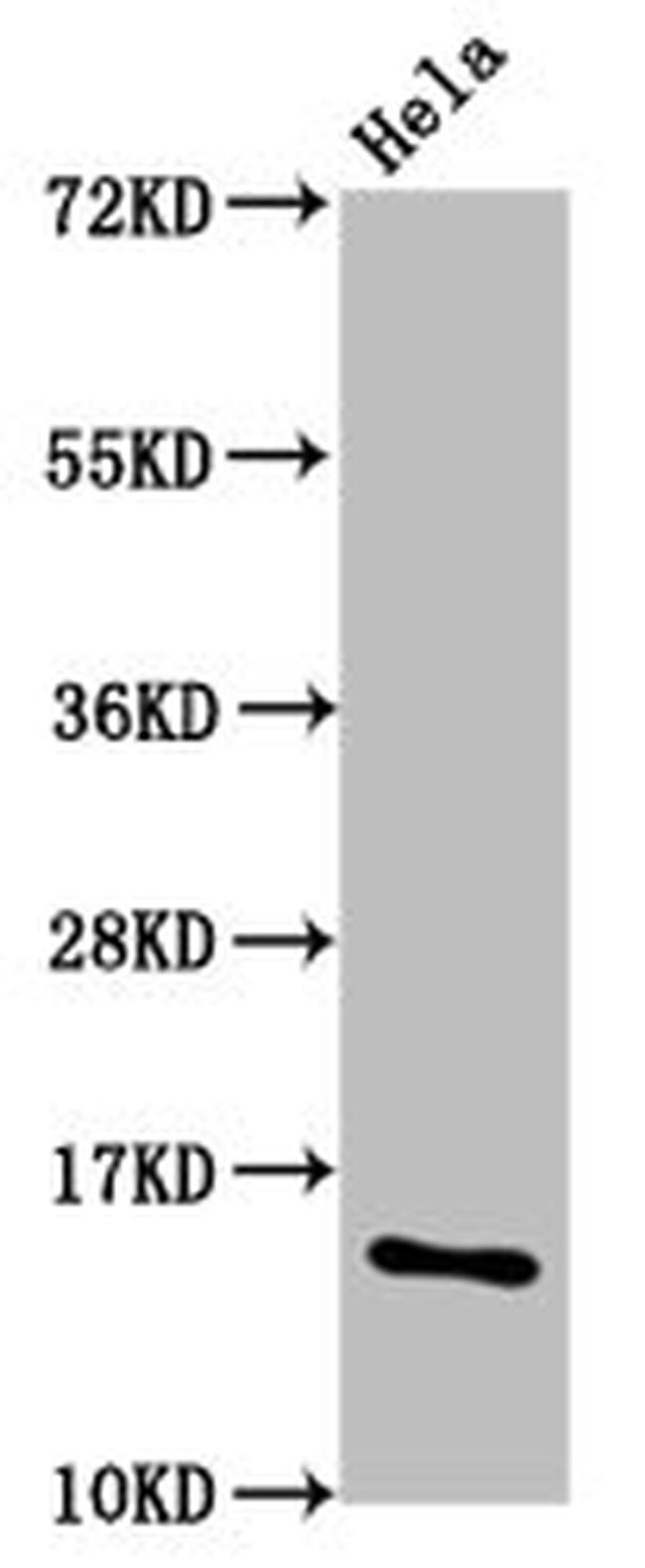 beta-hyroxybutyryl-Histone Macro-H2A.1 (Lys36) Antibody in Western Blot (WB)