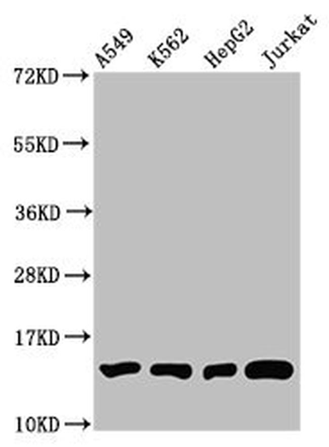 H2BK12me1 Antibody in Western Blot (WB)