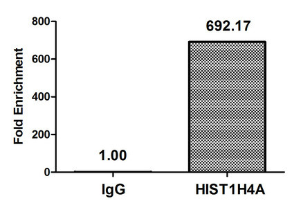 H4K5pr Antibody in ChIP Assay (ChIP)