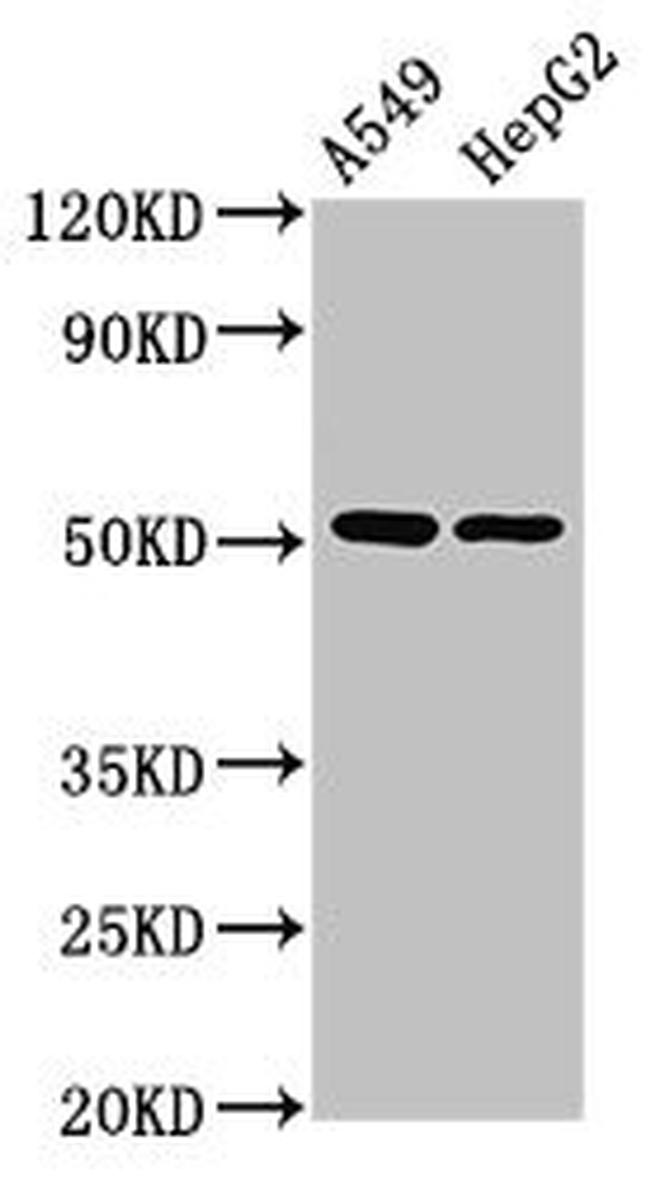 PPOX Antibody in Western Blot (WB)