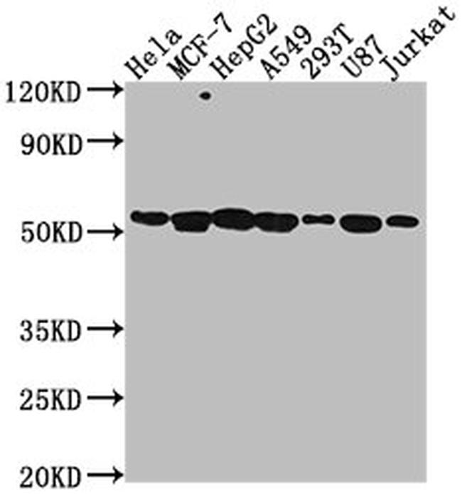 PRAMEF6 Antibody in Western Blot (WB)