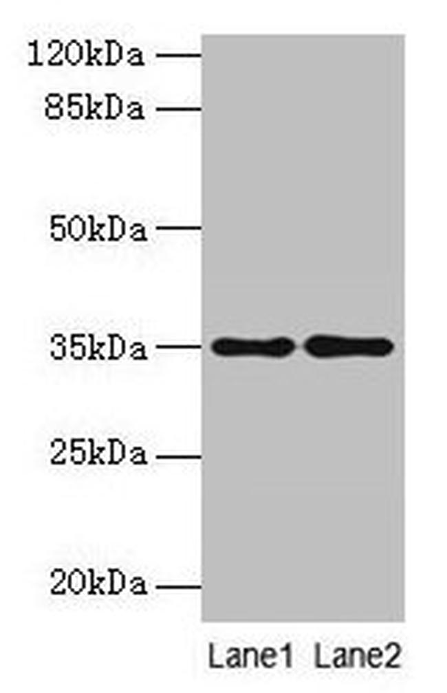 SDSL Antibody in Western Blot (WB)