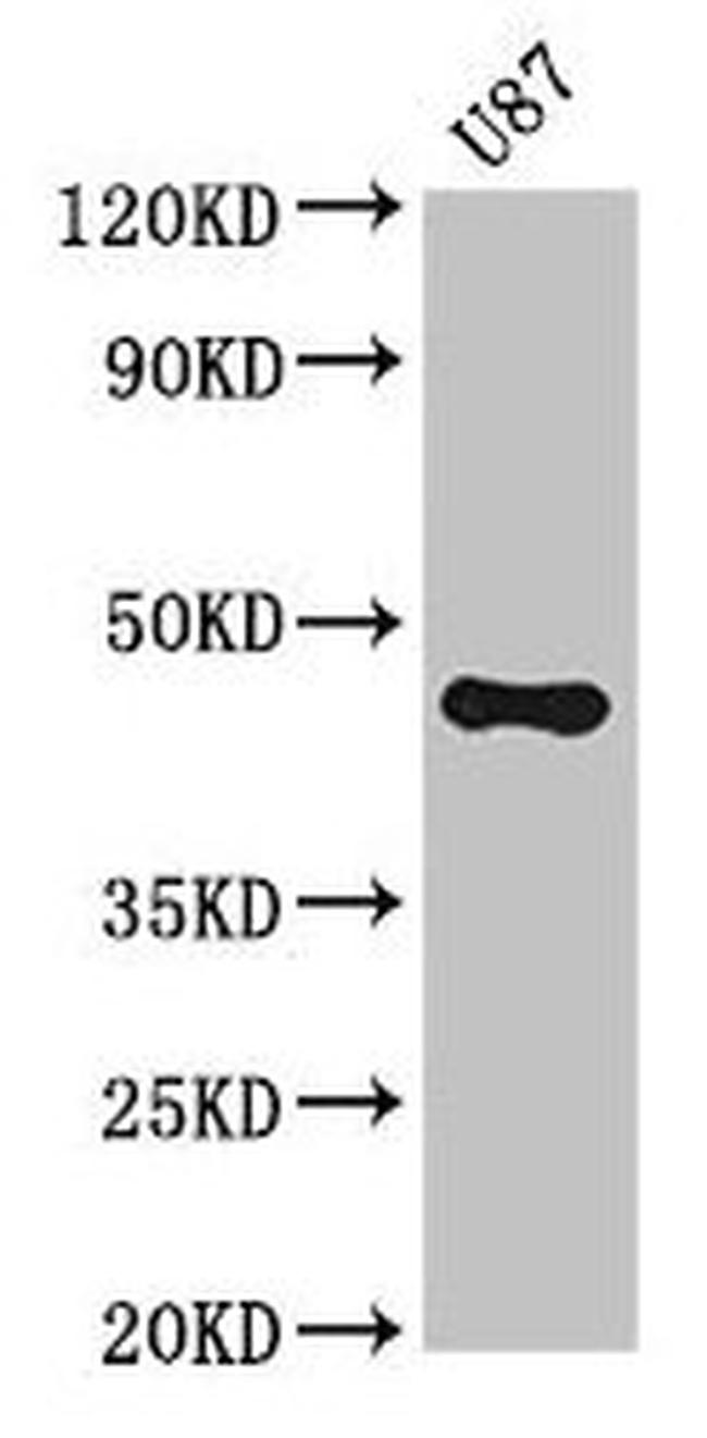 ST8SIA5 Antibody in Western Blot (WB)