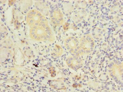 TM41A Antibody in Immunohistochemistry (Paraffin) (IHC (P))