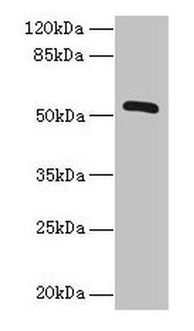 ZNF410 Antibody in Western Blot (WB)