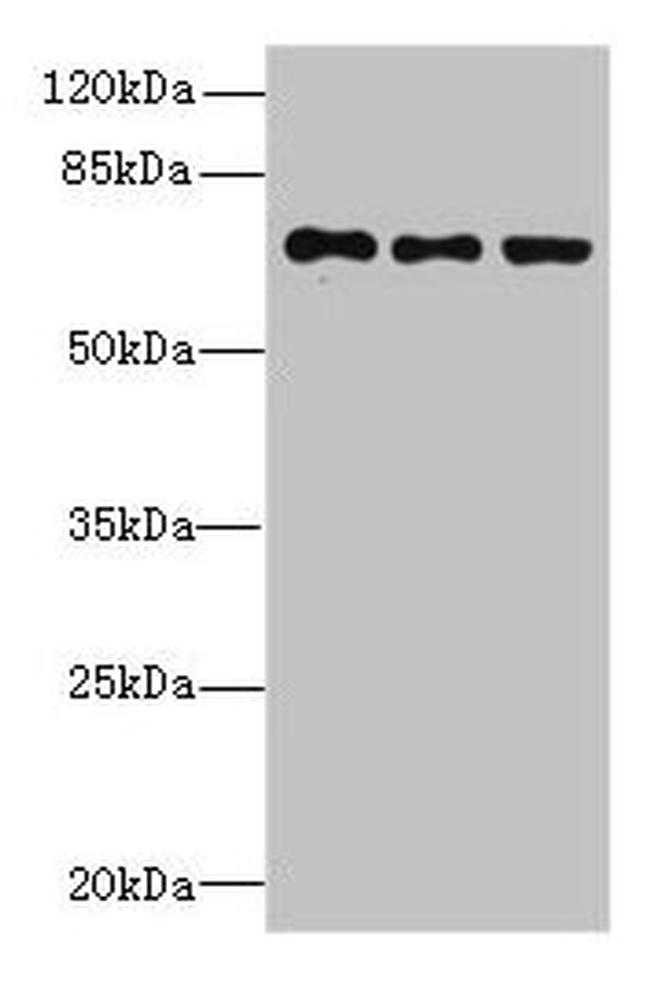 ZNF614 Antibody in Western Blot (WB)