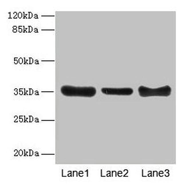 ZNF625 Antibody in Western Blot (WB)