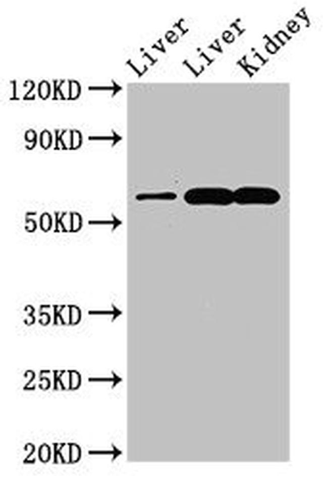 ZNF695 Antibody in Western Blot (WB)
