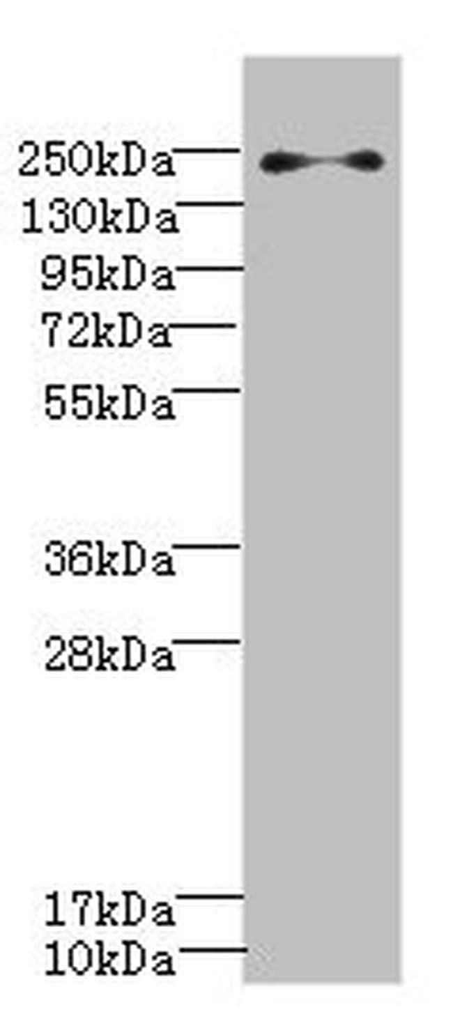 PLA2R1 Antibody in Western Blot (WB)