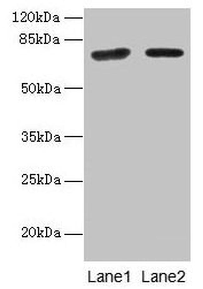 KLHL22 Antibody in Western Blot (WB)