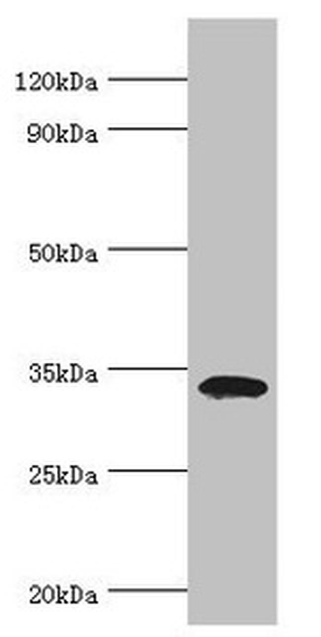 LDLRAP1 Antibody in Western Blot (WB)