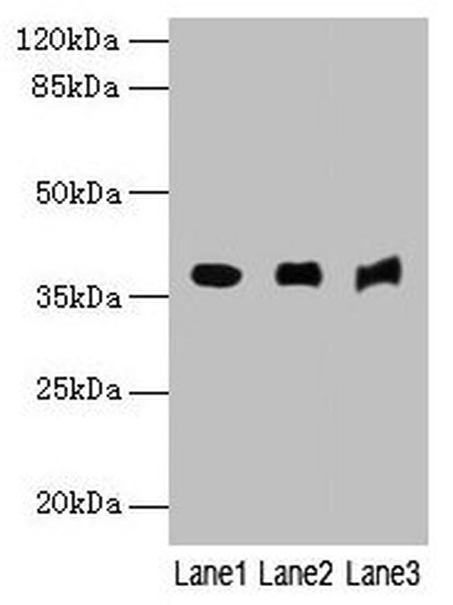 C5orf45 Antibody in Western Blot (WB)