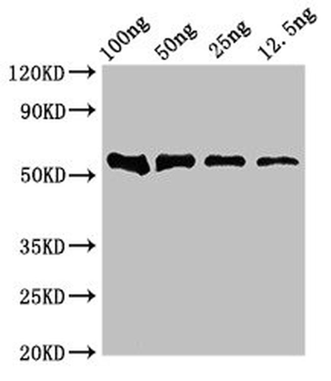 DNAH12 Antibody in Western Blot (WB)