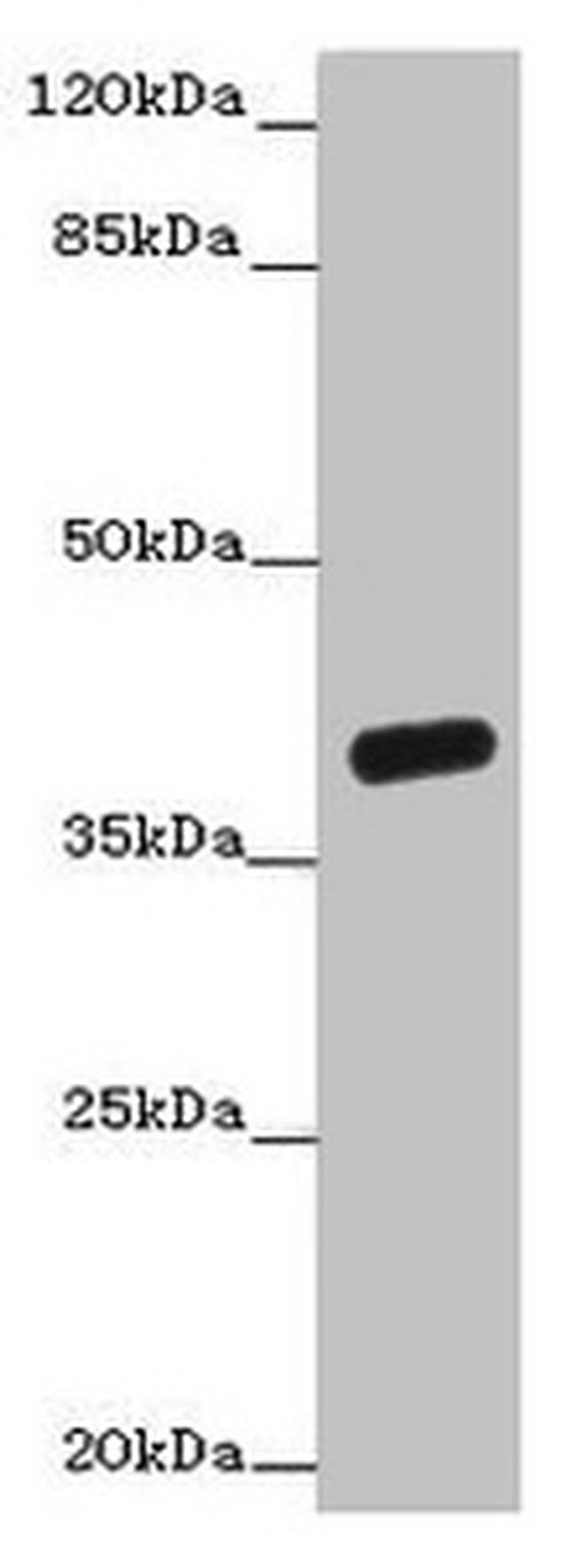 OGFOD2 Antibody in Western Blot (WB)