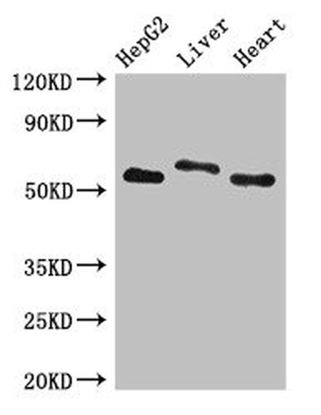 SLC13A5 Antibody in Western Blot (WB)