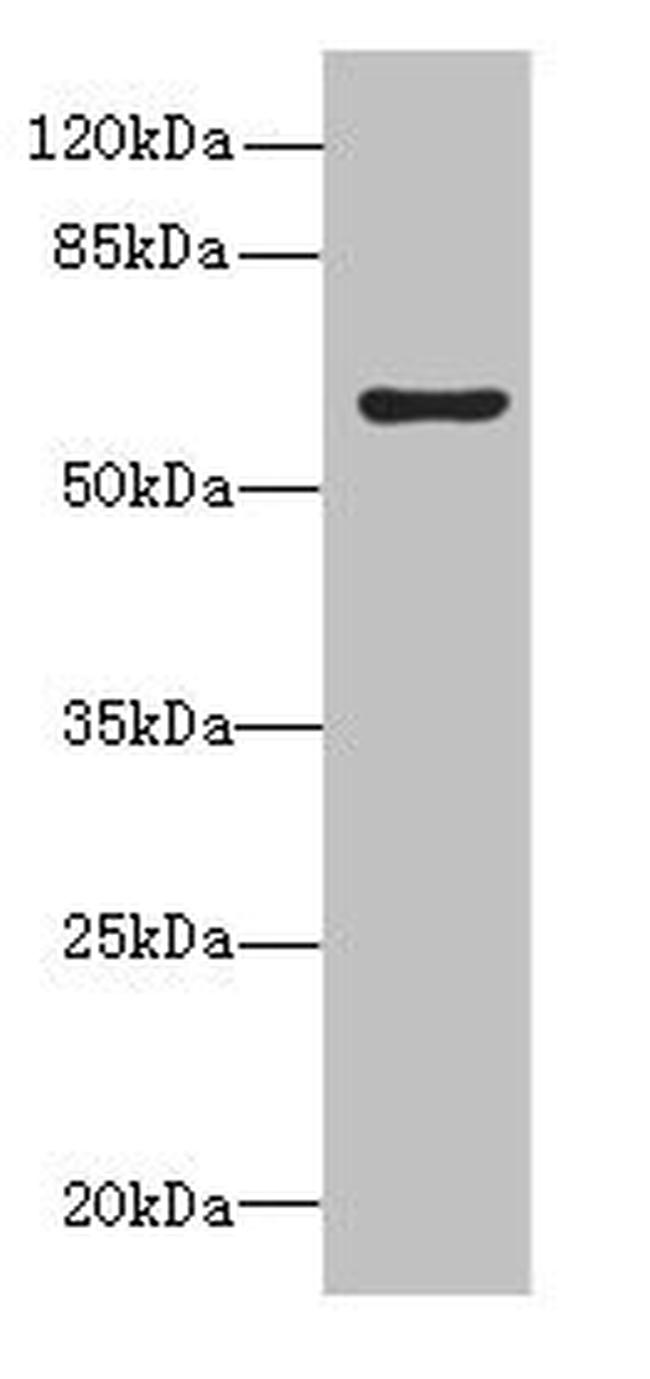 KIAA0907 Antibody in Western Blot (WB)