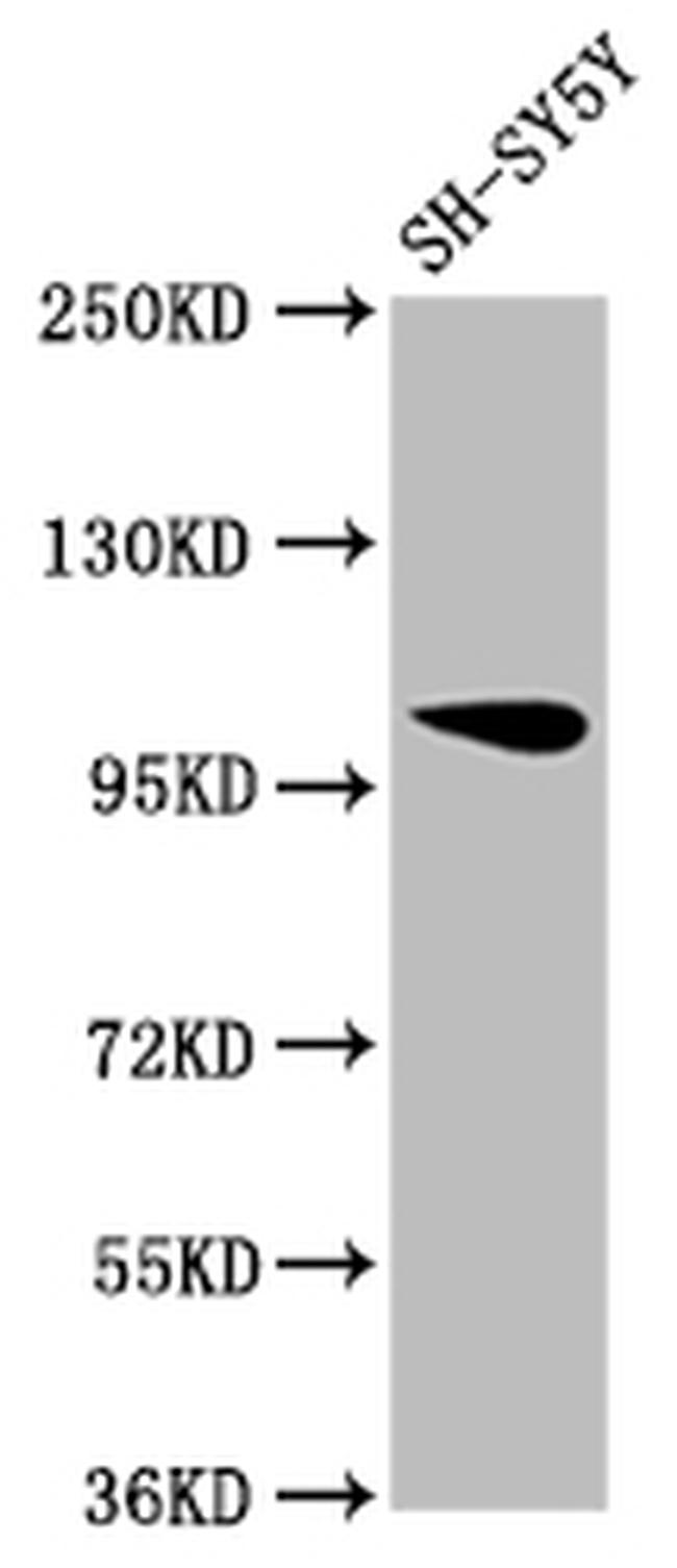VPS39 Antibody in Western Blot (WB)