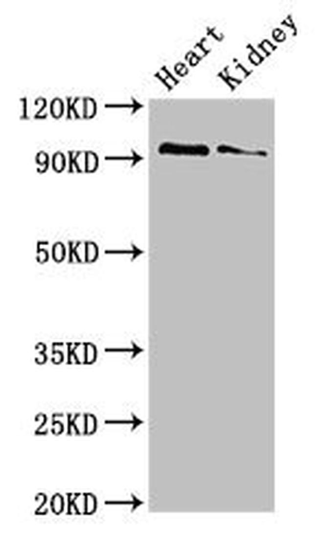 VPS39 Antibody in Western Blot (WB)