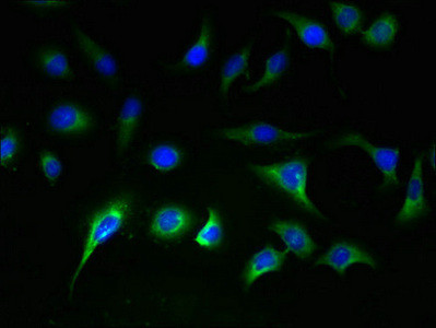 SLC25A36 Antibody in Immunocytochemistry (ICC/IF)