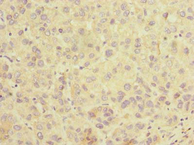 SLC25A36 Antibody in Immunohistochemistry (Paraffin) (IHC (P))