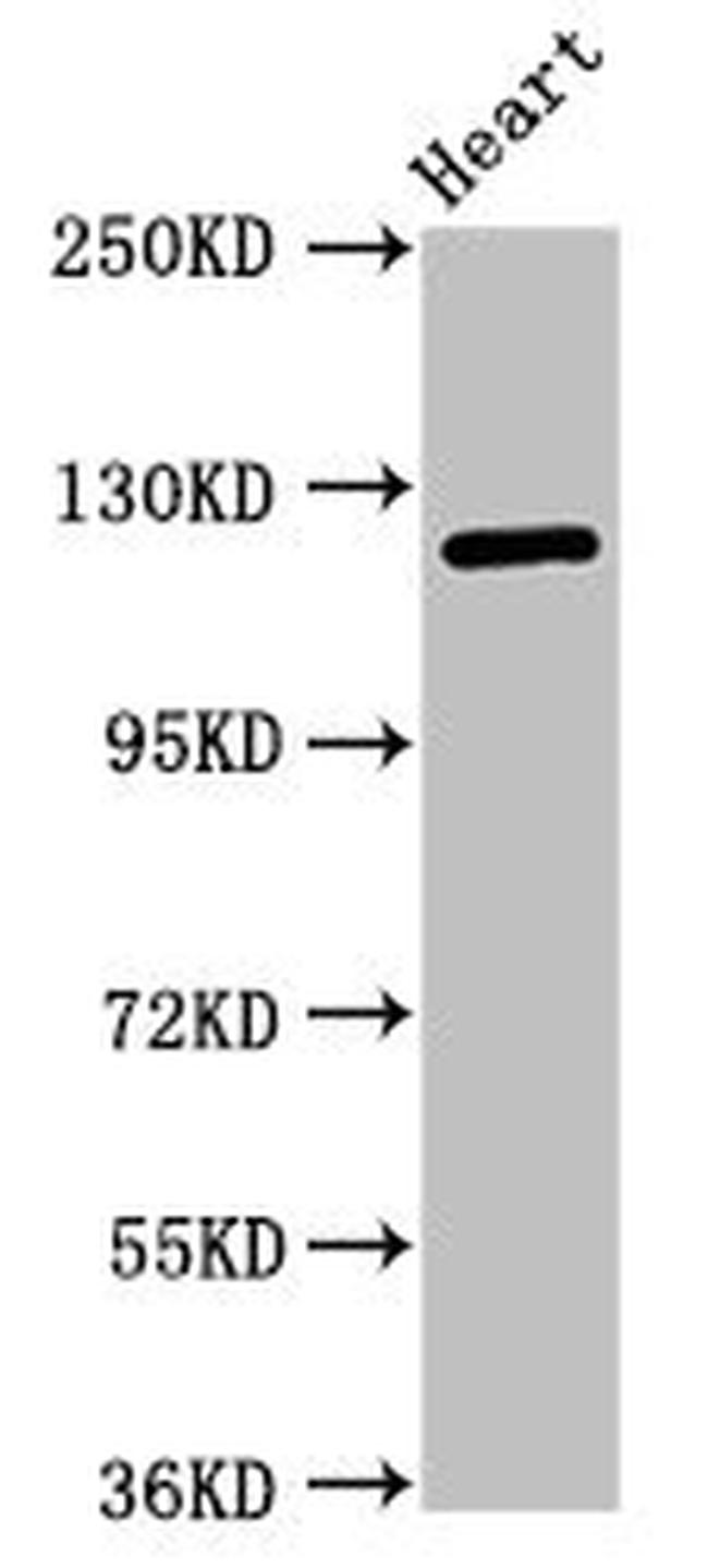 SEMA5B Antibody in Western Blot (WB)