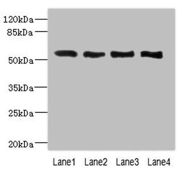 VANGL2 Antibody in Western Blot (WB)