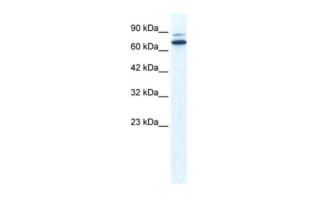 ZNF57 Antibody in Western Blot (WB)