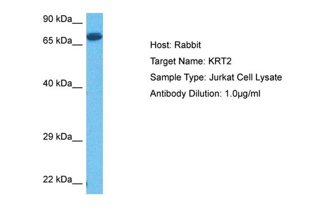 Cytokeratin 2e Antibody in Western Blot (WB)