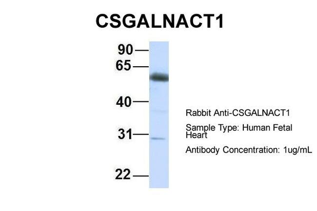 CSGALNACT1 Antibody in Western Blot (WB)