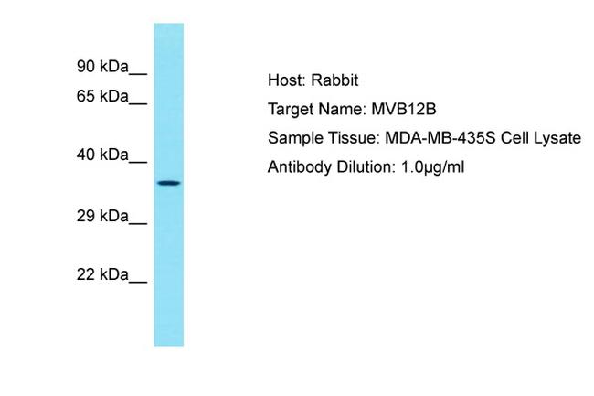 MVB12B Antibody in Western Blot (WB)